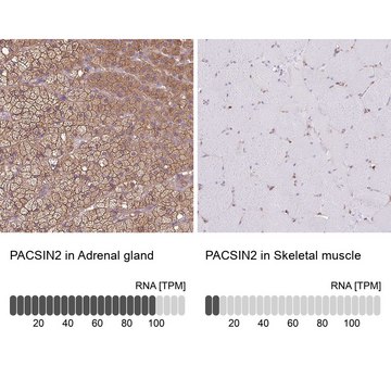 Anti-PACSIN2 antibody produced in rabbit