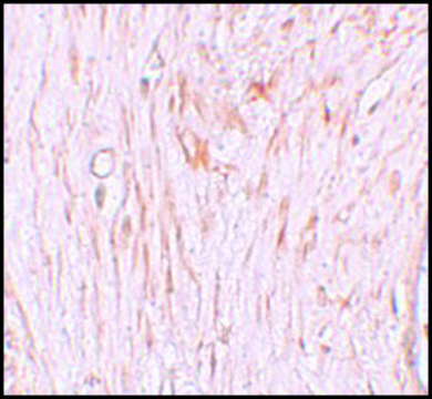 Anti-ZBTB7A antibody produced in rabbit