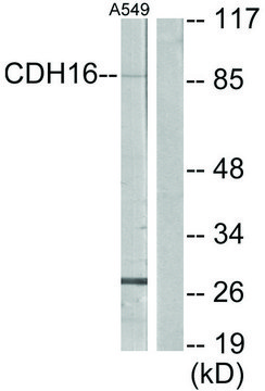 Anti-CDH16 antibody produced in rabbit