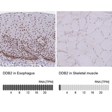 Anti-DDB2 antibody produced in rabbit