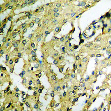 Anti-phospho-PYK2 (pTyr??¹) antibody produced in