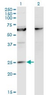 Monoclonal Anti-KCNIP1 antibody produced in
