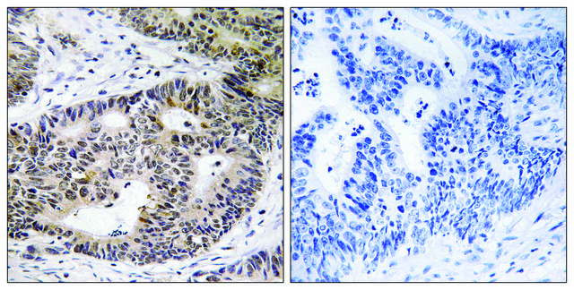 Anti-ZFYVE19 antibody produced in rabbit