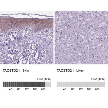 Anti-TACSTD2 antibody produced in rabbit