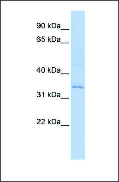 Anti-RNF113A antibody produced in rabbit