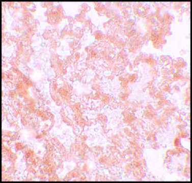 Anti-MFSD2A antibody produced in rabbit