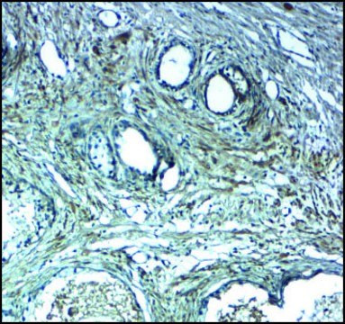 Anti-LRRC26 antibody produced in rabbit