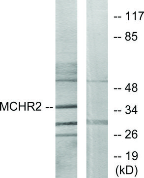Anti-MCHR2 antibody produced in rabbit