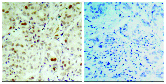 Anti-phospho-RB1 (pSer???) antibody produced in