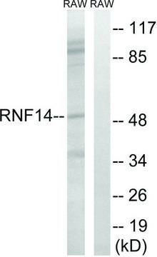 Anti-RNF14 antibody produced in rabbit