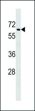 ANTI-MOUSE TGFBR2 (C-TERM) antibody produced