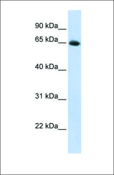 Anti-SLC2A4 antibody produced in rabbit