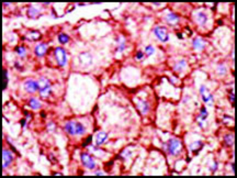 Anti-PFKP (N-term) antibody produced in