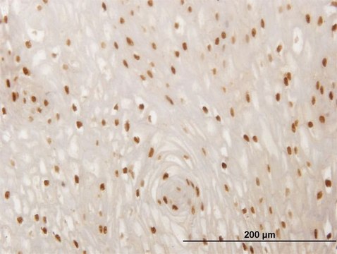 ANTI-SMAD6 antibody produced in mouse