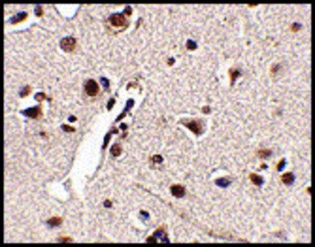 Anti-RKHD4 antibody produced in rabbit