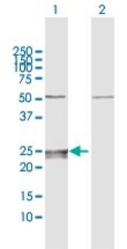Anti-CMPK1 antibody produced in rabbit