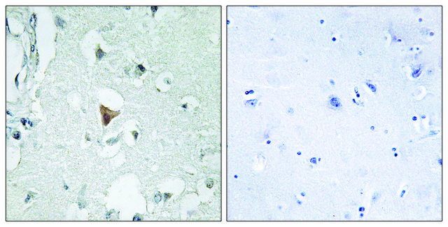 Anti-SAPK antibody produced in rabbit
