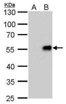 Monoclonal Anti-Influenza A virus H1N1