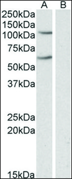Anti-IREB2 antibody produced in goat