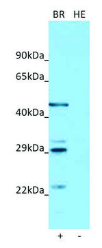 Anti-ASGR1 antibody produced in rabbit