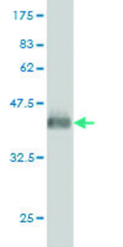 ANTI-GUCY2D antibody produced in mouse