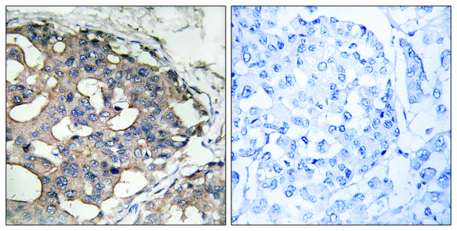 Anti-B-RAF antibody produced in rabbit