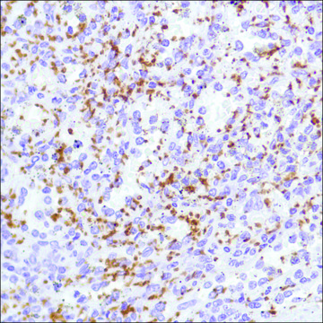 Anti-CD42B antibody, Rabbit monoclonal