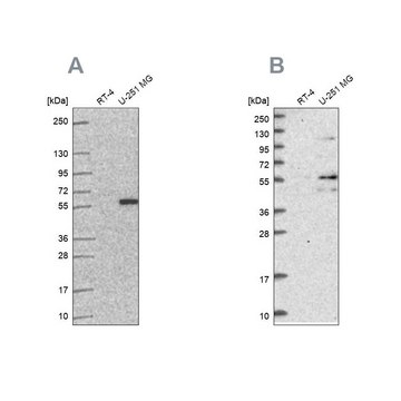Anti-ACSBG1 antibody produced in rabbit
