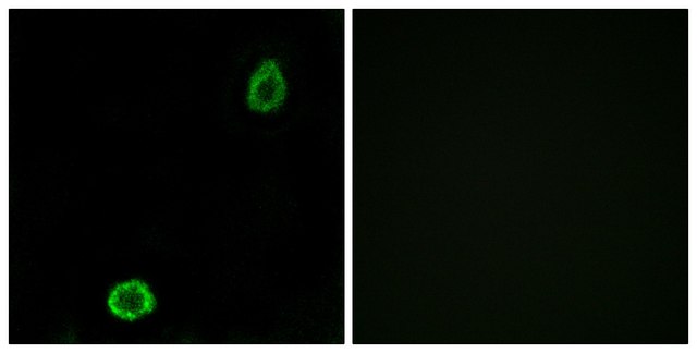 Anti-ABCA13 antibody produced in rabbit
