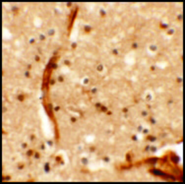 Anti-KCNK13 antibody produced in rabbit