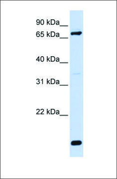 Anti-ACSL4 antibody produced in rabbit