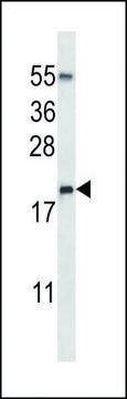 ANTI-RNASE3 (C-TERM) antibody produced in