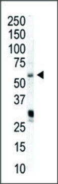 Anti-PIP5K1A (N-term) antibody produced in