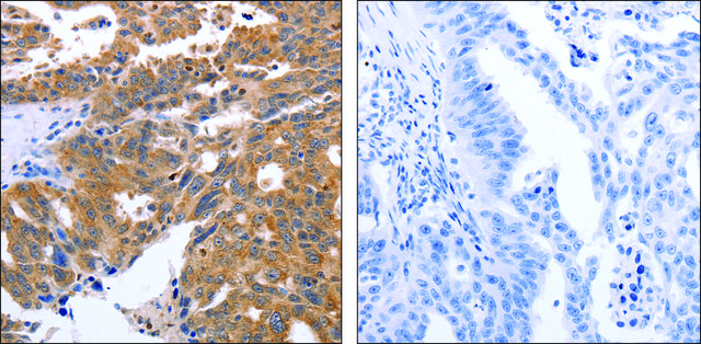 Anti-GEMIN2 antibody produced in rabbit