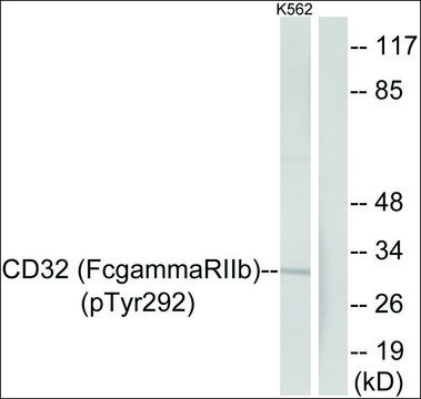 Anti-phospho-CD32 (pTyr²?²) antibody produced in