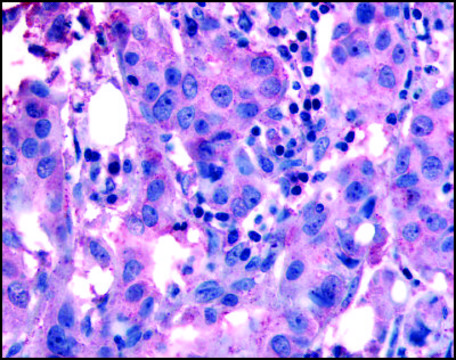 Anti-NANP (AB2) antibody produced in