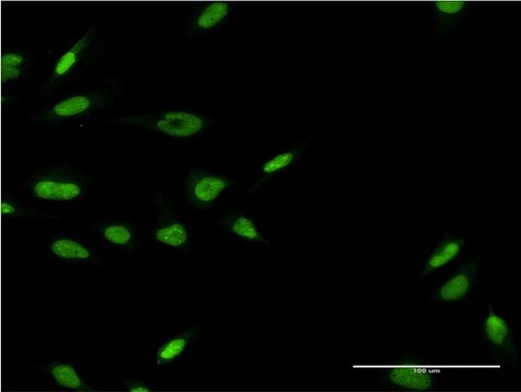 ANTI-LHX6 antibody produced in mouse