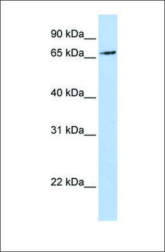 Anti-RNF139 antibody produced in rabbit