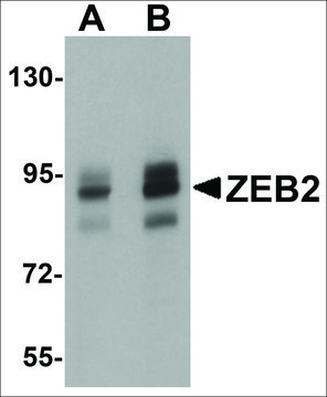 Anti-ZEB2 antibody produced in rabbit