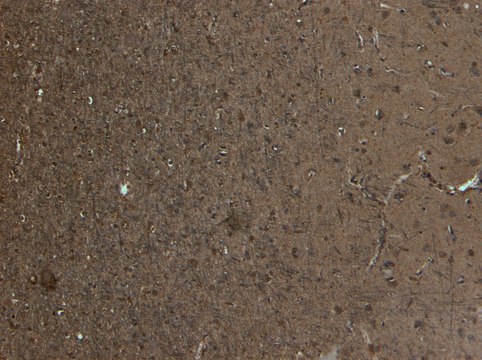Anti-Kalirin (Isoform 2) antibody produced