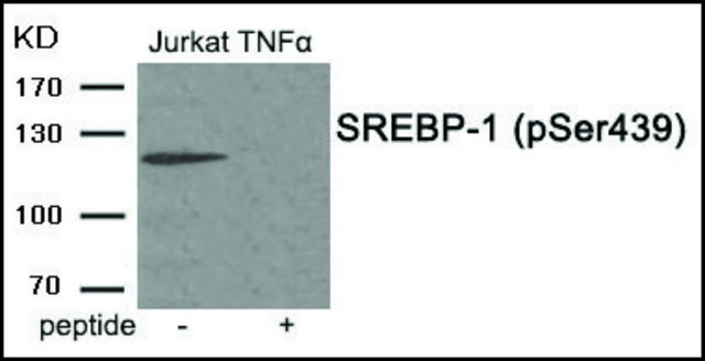 Anti-phospho-SREBP-1 (pSer?³?) antibody produced in