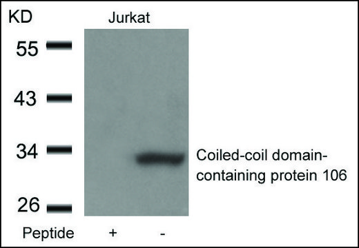 Anti-CCDC106 antibody produced in rabbit
