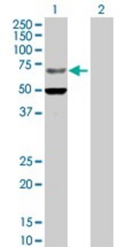 Anti-ZNF182 antibody produced in rabbit