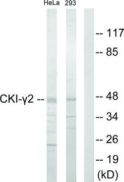 Anti-CKI-?2 antibody produced in rabbit