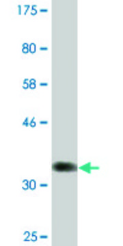 Monoclonal Anti-NDOR1 antibody produced in