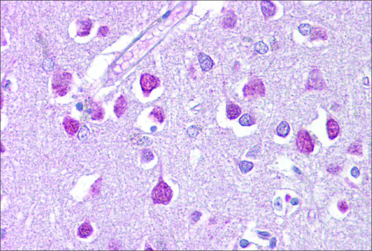 Anti-ETV1 antibody produced in rabbit