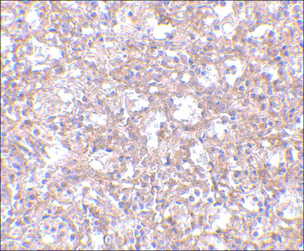 Anti-TEM4 antibody produced in rabbit
