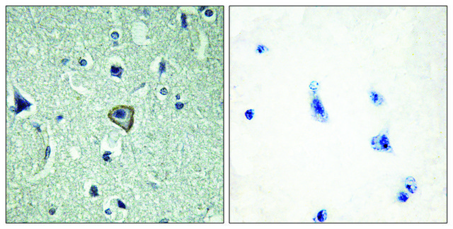 Anti-BAI2 antibody produced in rabbit