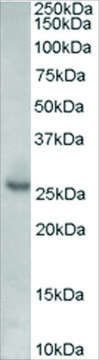 Anti-KIP1/CDKN1B, Internal antibody produced in