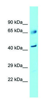 Anti-FAM83A (C-terminal) antibody produced in